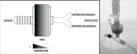 Humidificación pasiva en ventilación mecánica CAMPUS KINESICO