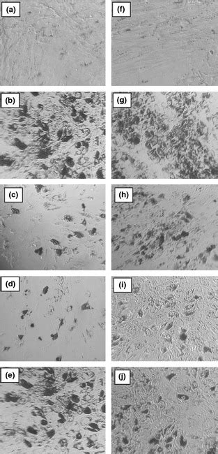 Adipogenic Differentiation Capacity Of Sf Msc Oil Red O Staining Of