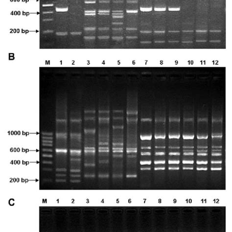 Rep Pcr Fingerprinting Assay Of Xanthomonas Isolates Causing Bacterial