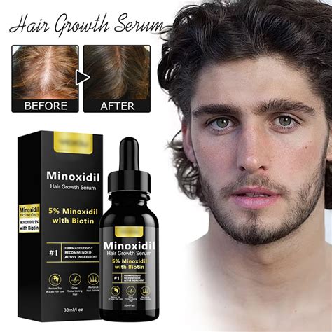 For Men And Women 5 Percent For Hair Loss Hair Regrowth For Thicker Fuller Hair For Hair Growth