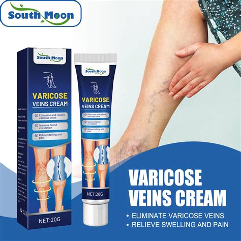 South Moon Venous Massage Varicose Cream Relieves Leg Vascular Protrusion Choroid Varicose