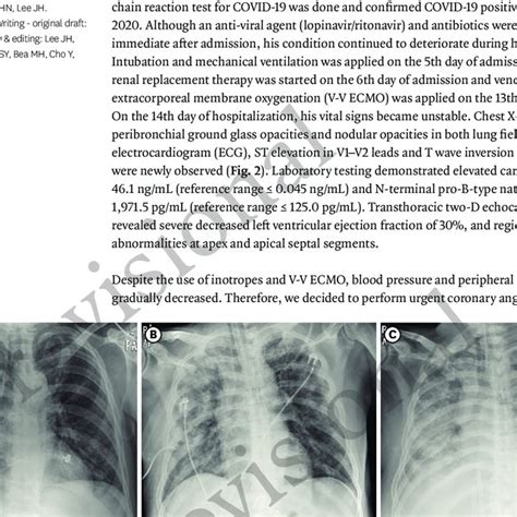 Blood-tinged sputum after receiving second low dose of dabigatran ...