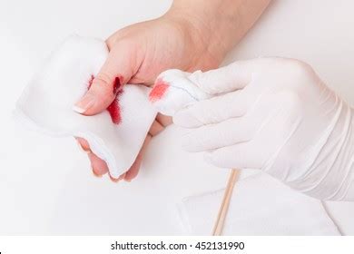 Treatment Deep Wound Stock Photo (Edit Now) 452131990