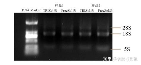 手把手教学——rna提取的实验步骤and注意事项 知乎