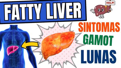 Fatty Liver Gamot At Lunas Sintomas Mga Bawal At Dapat Kainin Sa