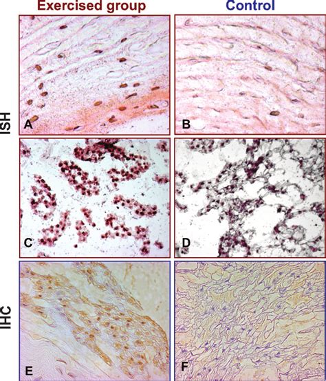 Increase In Mrna And Protein Expression Of Collagen 2 In The Disc After Download Scientific