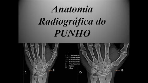 Anatomia Radiogr Fica Do Punho Youtube