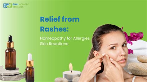 Relief From Rashes Homeopathy For Allergies Skin Reactions