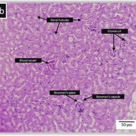 Histopathology Of The Spleen A The Spleen Of Male Balbc Mice Treated