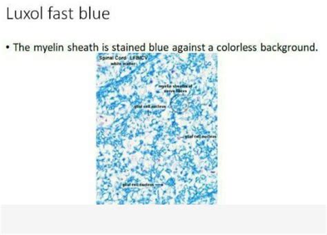 Luxol Fast Blue Stain Medizzy