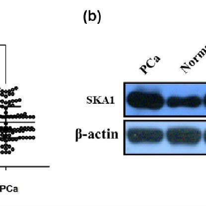 A Qrt Pcr Showing Expression Level Of Ska Mrna In Pca Tissues B