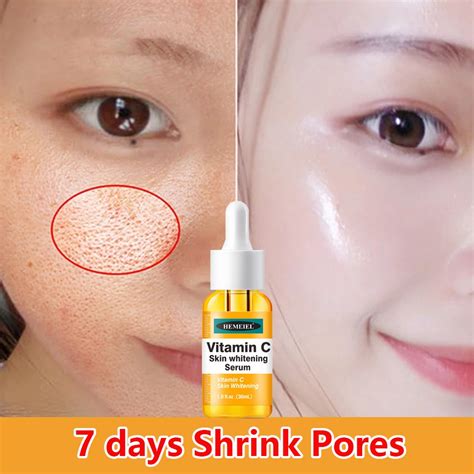 Hemeiel Vitamin C Serumwhite Melasmadark Spot Remover For Face