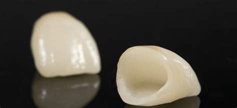 What Is Pressed Ceramic Dental Crown News Dentagama