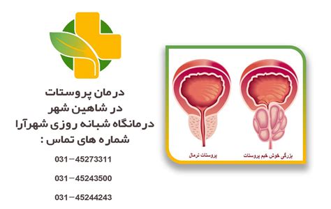 درمان پروستات در شاهین شهر مرکز جراحی و کلینیک شبانه روزی شهرآرا