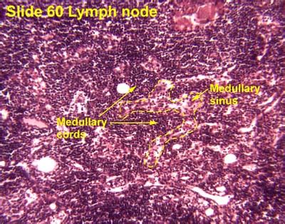 Lymph Node Microscope Slide