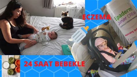 BEBEKLE EVDE BİR GÜNÜM NASIL GEÇİYOR Bebekte Egzema YouTube