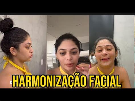 Rayssa buq fala sobre a harmonização facial YouTube