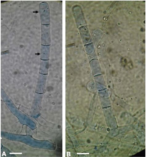 Powdery Mildew Caused By Podosphaera Lini On Linum Usitassimum Var