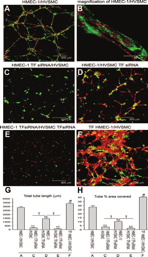 Human Vascular Smooth Muscle Cells HVSMCs Promote Vascular Stability