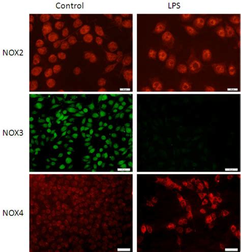 Microglia Show Expression Of NOX2 NOX3 And NOX4 In Vitro After