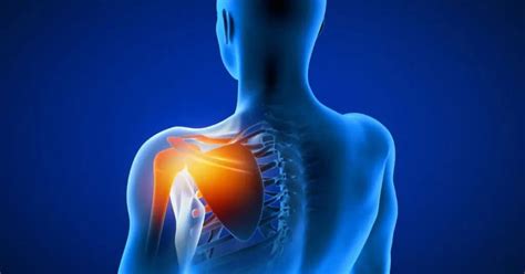 Shoulder Pain Specialists Nyc Orthopedic Division Nysi