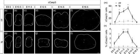 Sox9 overexpression exerts multiple stage‐dependent effects on mouse ... 