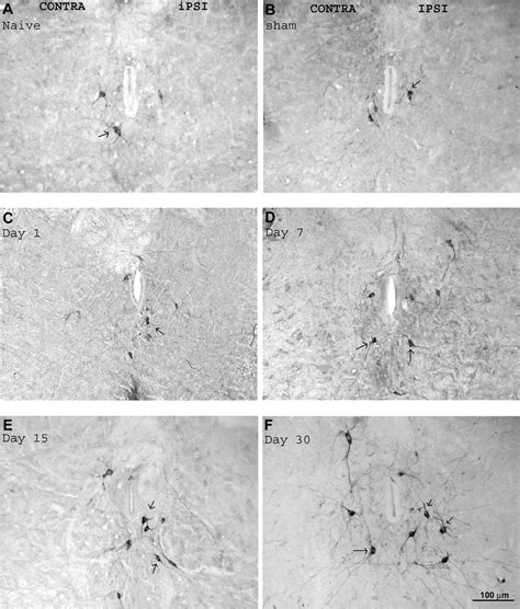 Digital Images Of Neuronal Nitric Oxide Synthase NNOS Immunostaining