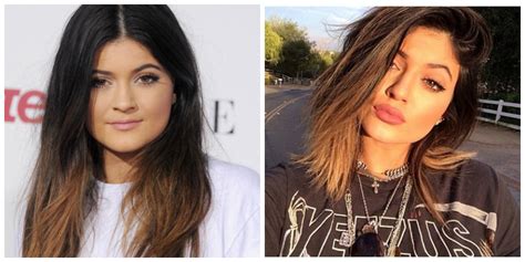 Did Kylie Jenner Get Plastic Surgery? | StyleCaster