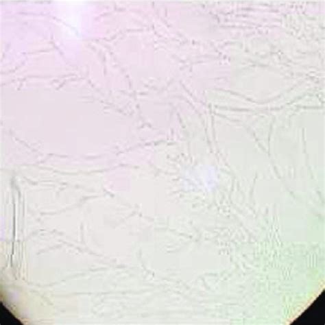 Colonies Grown On Chromagar Candida For Hours At C A C