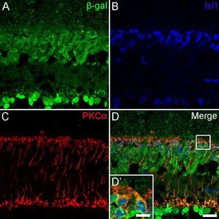 Rod Bipolar And ON Cone Bipolar Cells Are Reduced And Abnormally