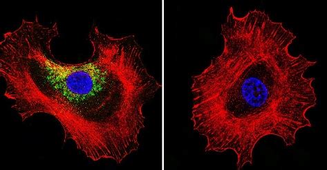 Anti Prolactin Receptor PRL R Antibody U5 Ab2772 Abcam