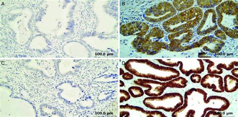 Immunohistochemical Staining Result Showed Gsk3β Negative A Ps9gsk3β Download Scientific