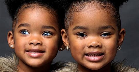 Twins With Unusual Eyes Are Already 8 Years Old And They Are Amazingly