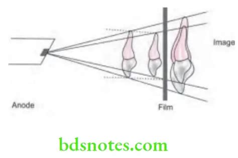 Intraoral Radiographic Techniques Question And Answers Bds Notes