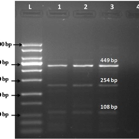 Nested PCR Amplified SSU RRNA Fragments Of Cryptosporidium Line 1