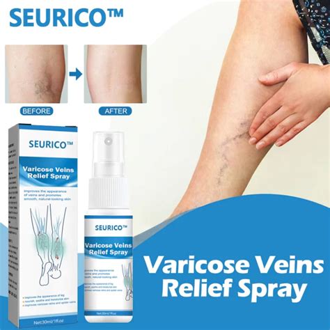 Seurico Vein Varicose Relief Spray Wizzgoo Shop