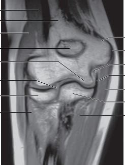 Coronal Mri Of The Elbow Diagram Quizlet