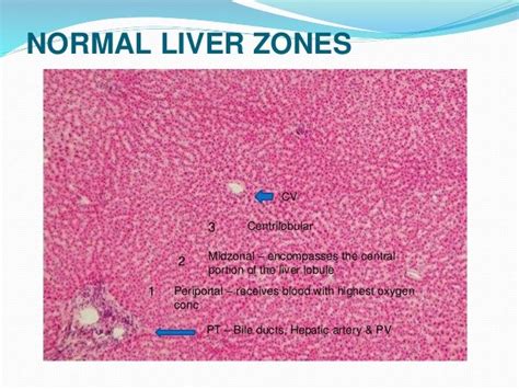 Liver Zones Histology