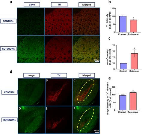 Effect of rotenone on expression of α syn and TH in striatum and α syn