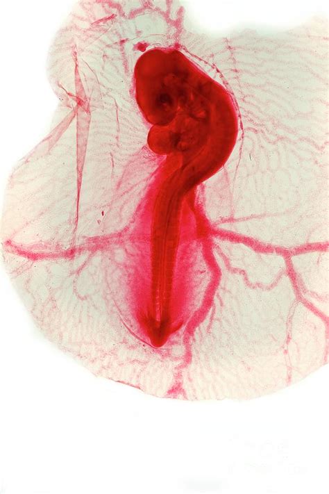 Chicken Embryo Photograph By Dr Keith Wheelerscience Photo Library