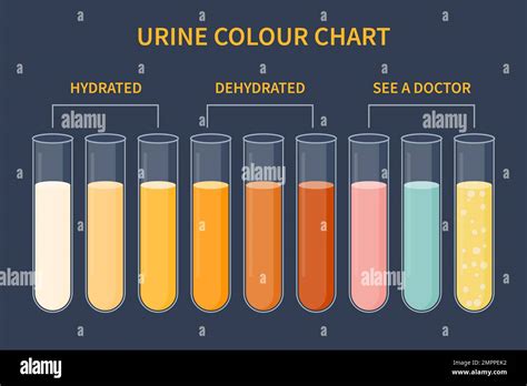 Urine Color Chart Illustration Of Dehydration Level Stock Vector Image And Art Alamy