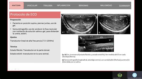 Evaluación del Pene mediante Ecografía y Resonancia YouTube