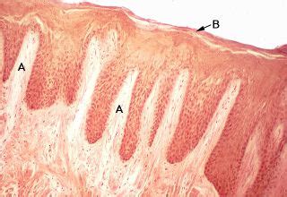 Oral Histology Digital Lab Mucosa Section Through Oral Mucosa Image 16