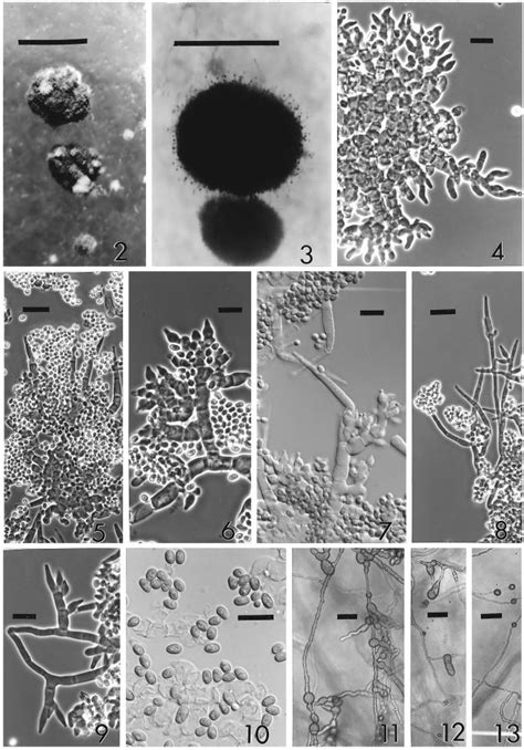 Trichoderma Stromaticum Figs Conidial Pustules Formed On Cmd In