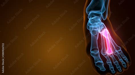 3d illustration of the skeleton metatarsal bone anatomy Stock ...