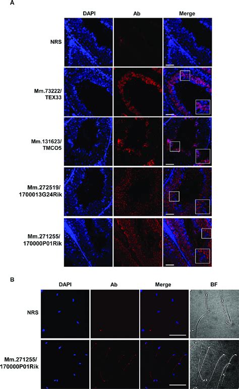 Localization Of The Novel Proteins In Adult Testis A Download