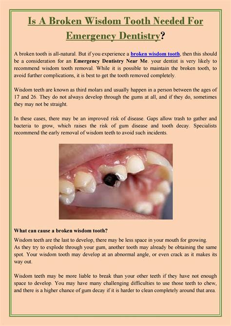 Broken Wisdom Tooth