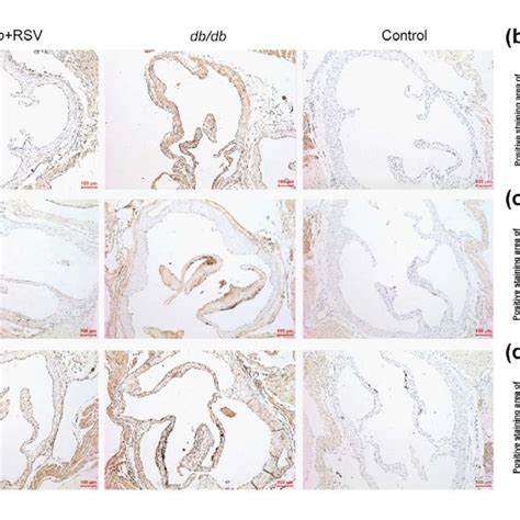 Sirt Expression In Major Organs And Aortic Tissues Of Treated And