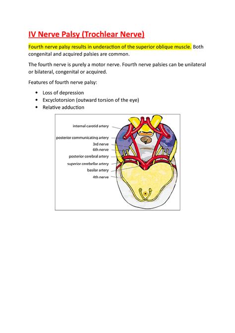 Iv Nerve Palsy Notes Iv Nerve Palsy Trochlear Nerve Fourth Nerve