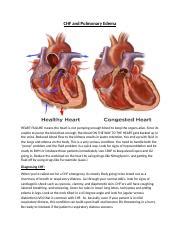 Understanding CHF and Pulmonary Edema: Causes, Symptoms, and | Course Hero